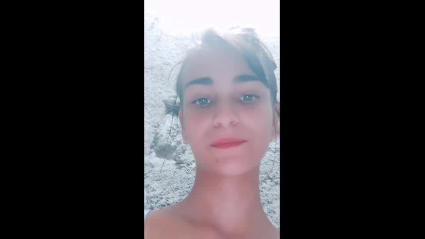 MYD-SPG-CHAMET-1222024- 927